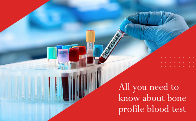 About Bone Profile Blood Test – All You Need To Know